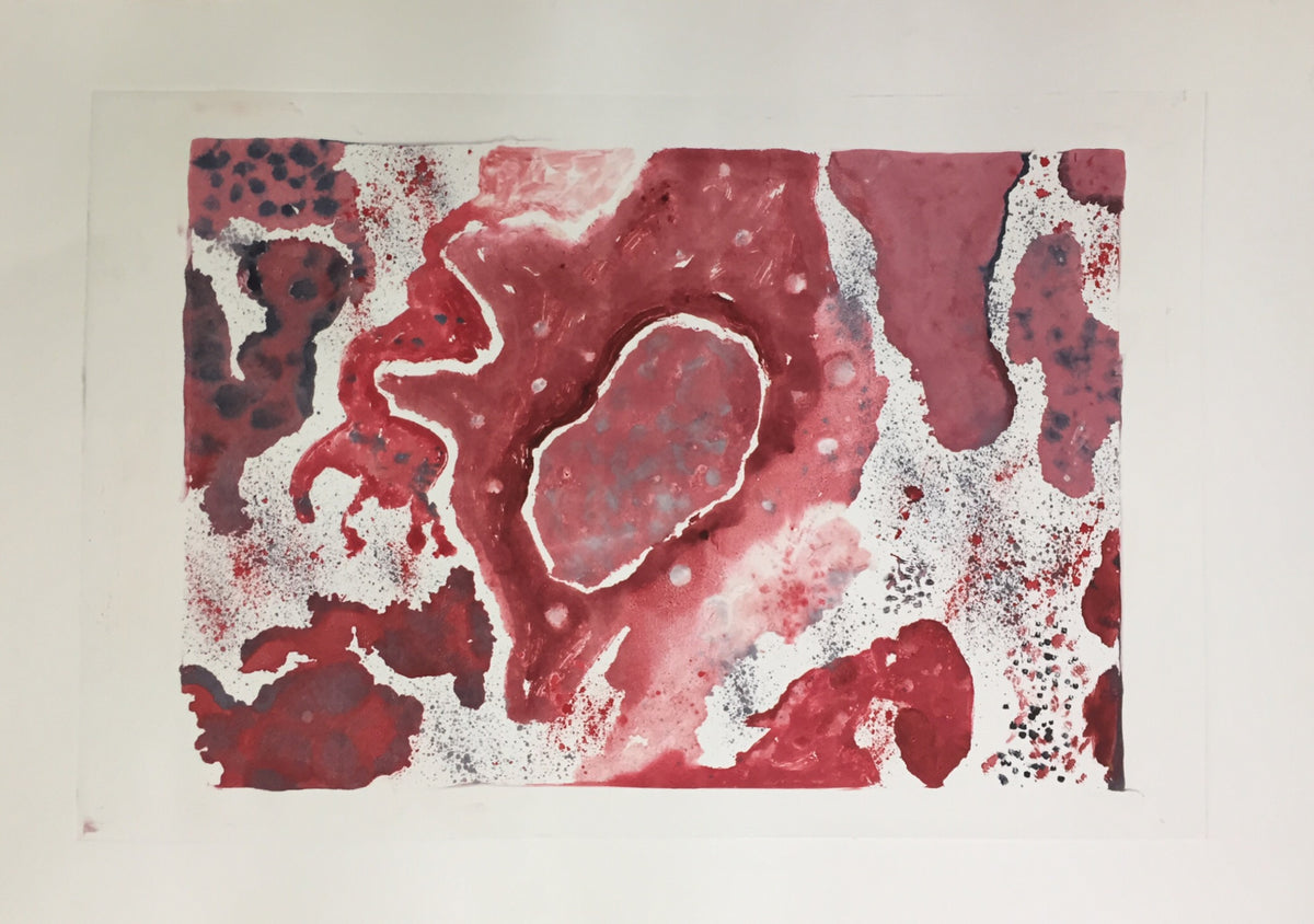 Metastasis I
