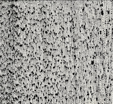 Static; Unending Voices I