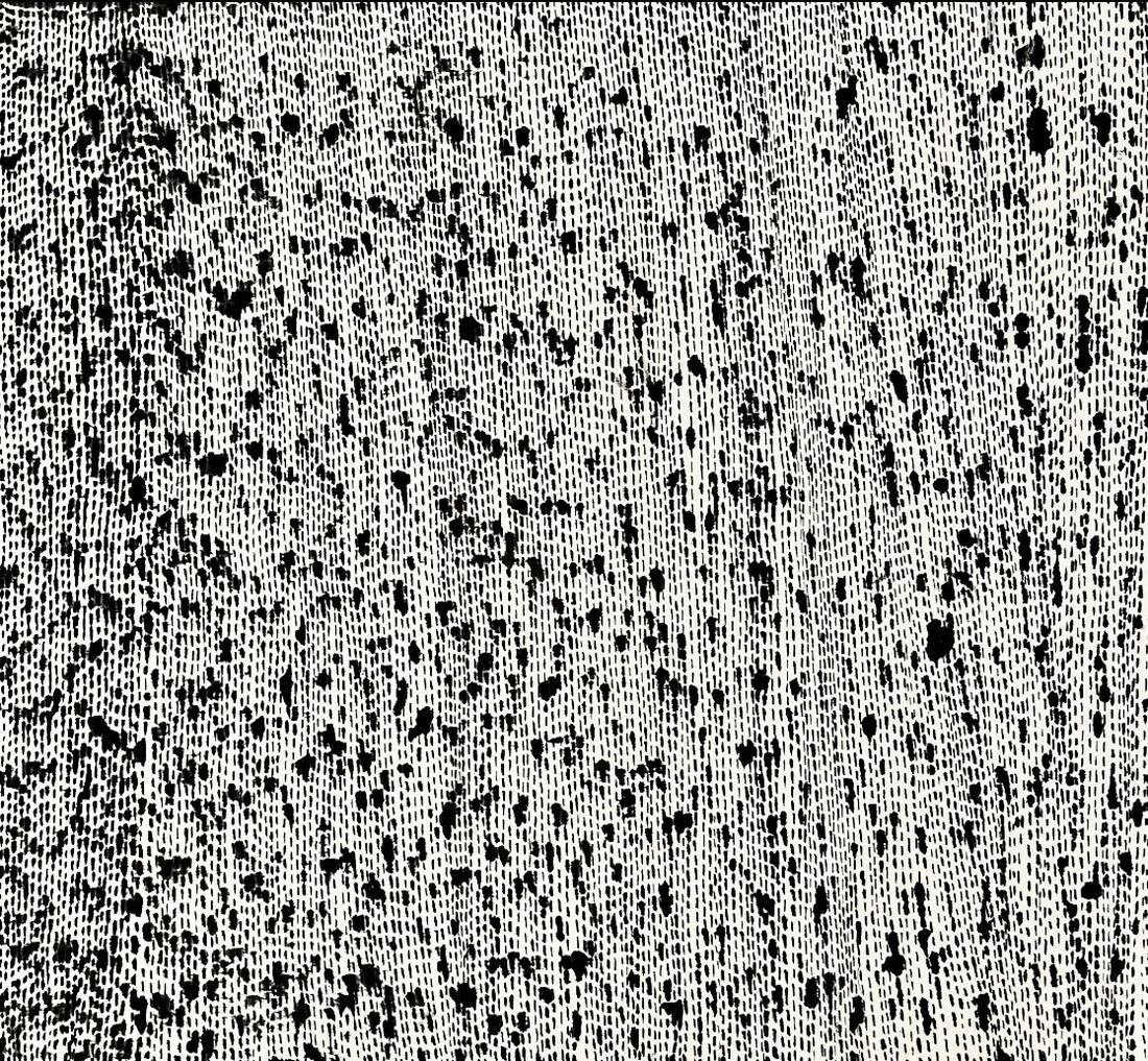 Static; Unending Voices I