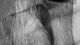 Emma Alice Coppola-Soft Skin - No Touch II